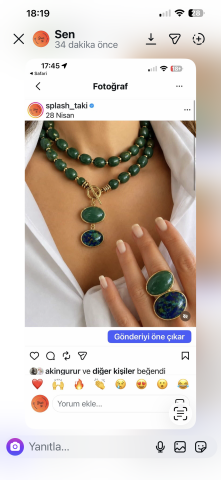 Özel link